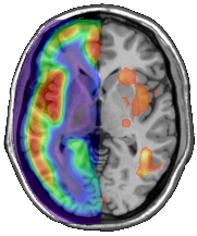 functional Neuroimaging Group Logo