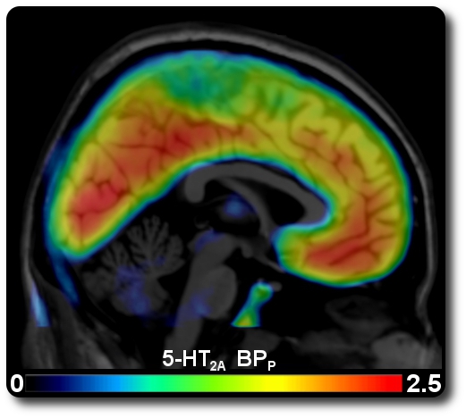 Serotonin-2A Receptor Distribution Map