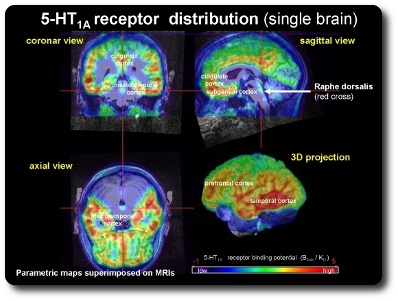 5HT1a Distribution