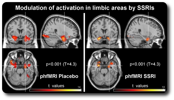 phfMRI