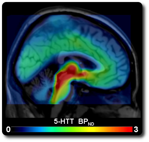 Serotonin Transporter Distribution Map