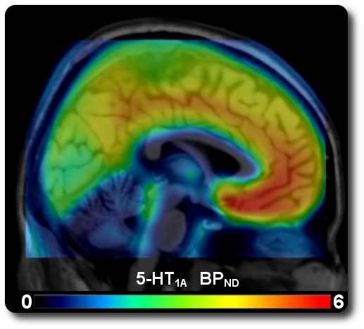 Serotonin-1A Receptor Distribution Map