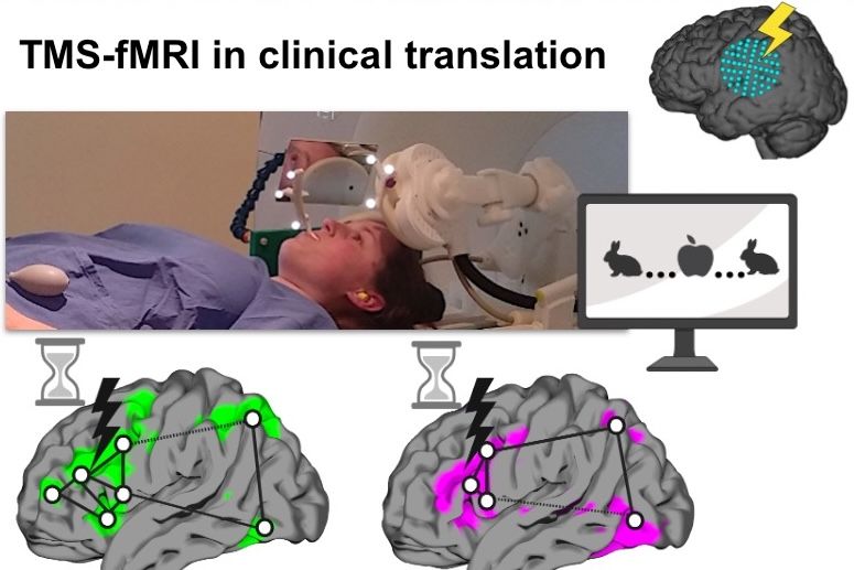 Tik grou: TMS-fMRI in clinical translation