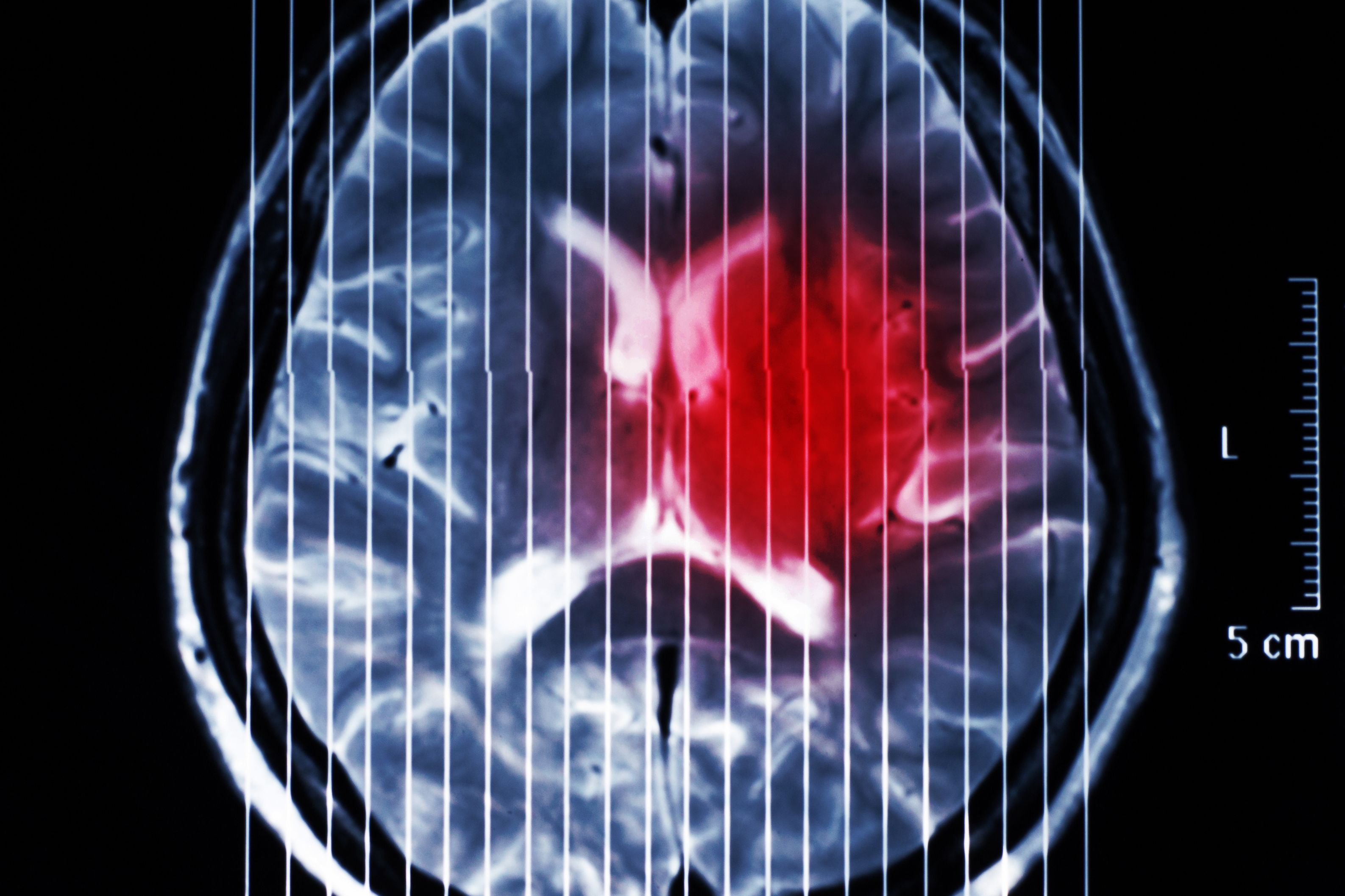 (c) 2015 T-Photo/Shutterstock