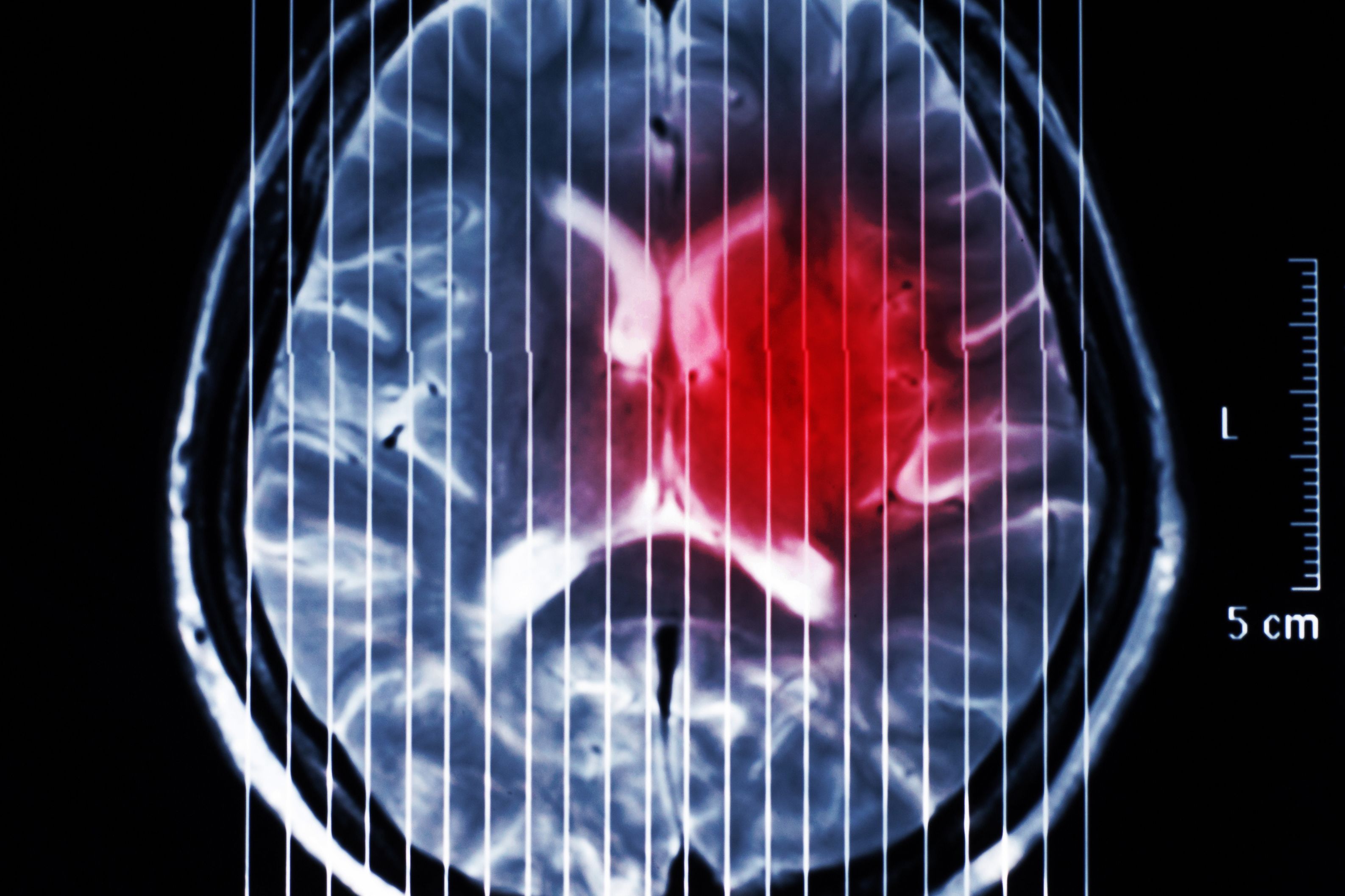 (c) 2015 T-Photo/Shutterstock