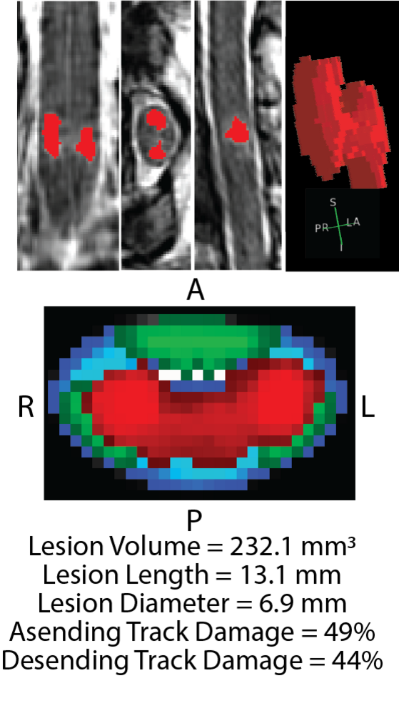 3D Lesionen
