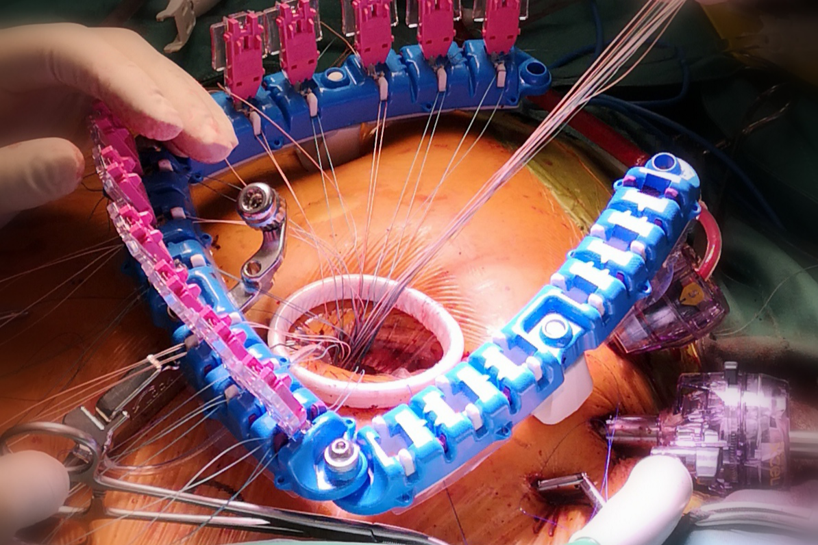 © MedUni Wien/Sahra Tasdelen