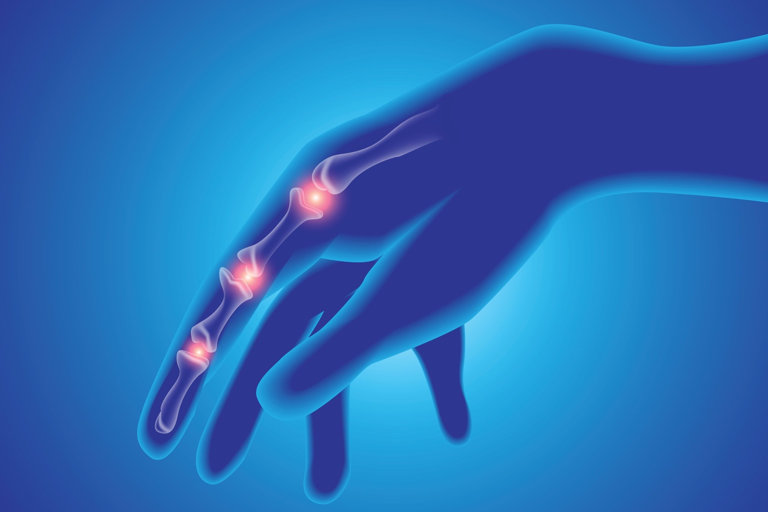 (c) 2021 RATTANAPRON WONGSALUNG/Shutterstock