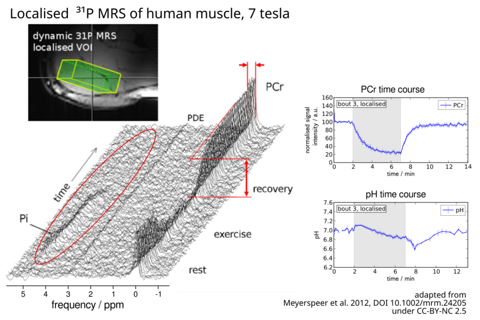 ³¹P MRS in human muscl