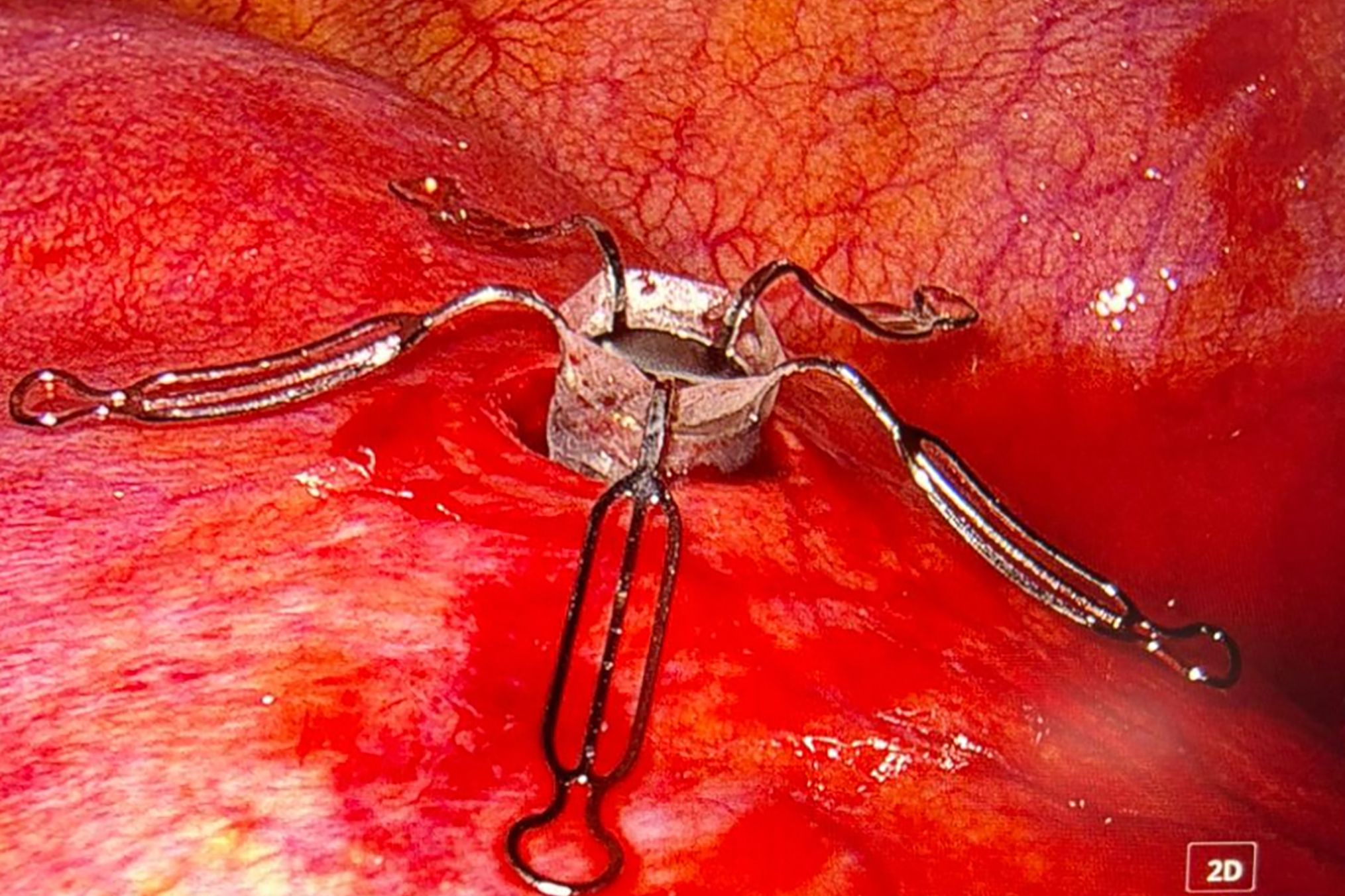 © C. Aigner/MedUni Wien/AKH Wien