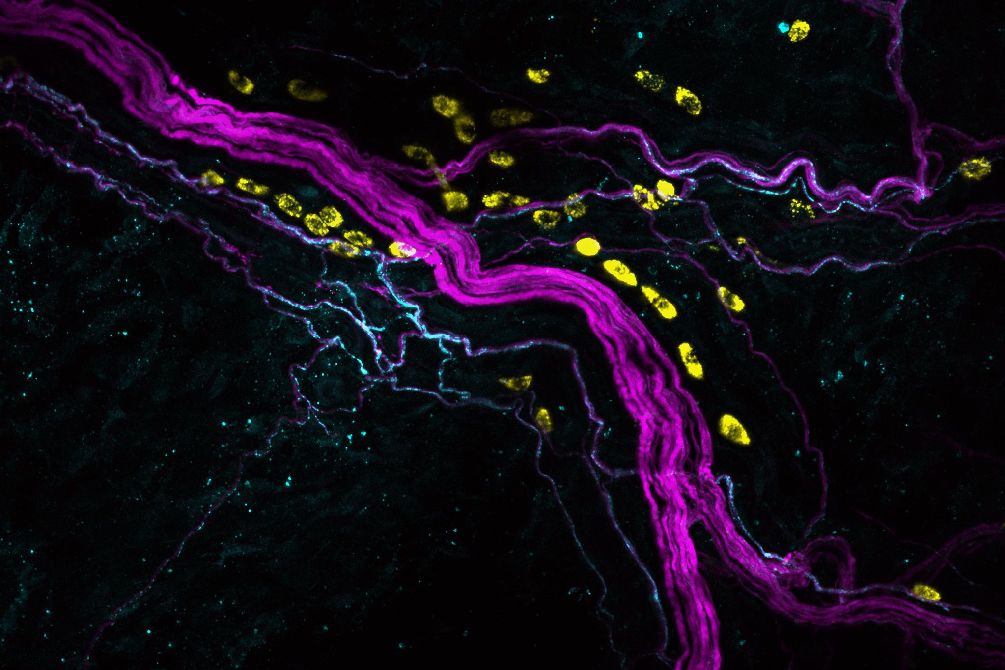 (c) R. Jain/S.Tikoo/MedUni Wien