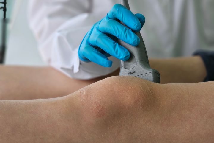 Ultraschalluntersuchung des Knies durch eine Ärztin mit blauen Handschuhen in einem Behandlungsraum.