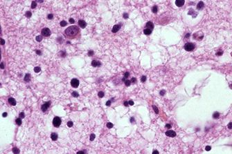 Histologischer Querschnitt