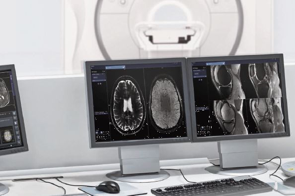 [Translate to English:] Bild: Siemens Healthineers