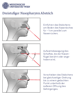 CGforStock-shutterstock.com/MedUni Vienna