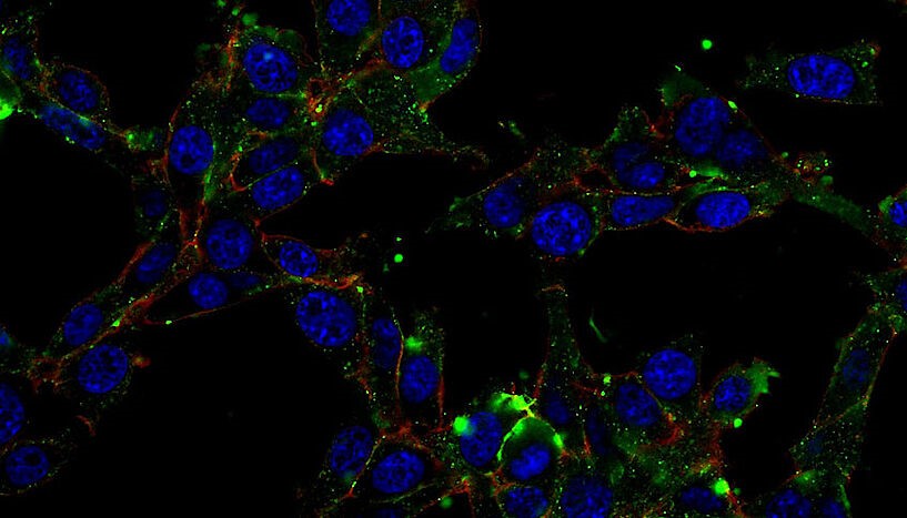 Im Bild: Albumin Uptakes in Zellkultur oder Tumorgewebe: blau: Nukleus, rot: Zellmembran, grün: Albumin. (© Hemma Schüffl)