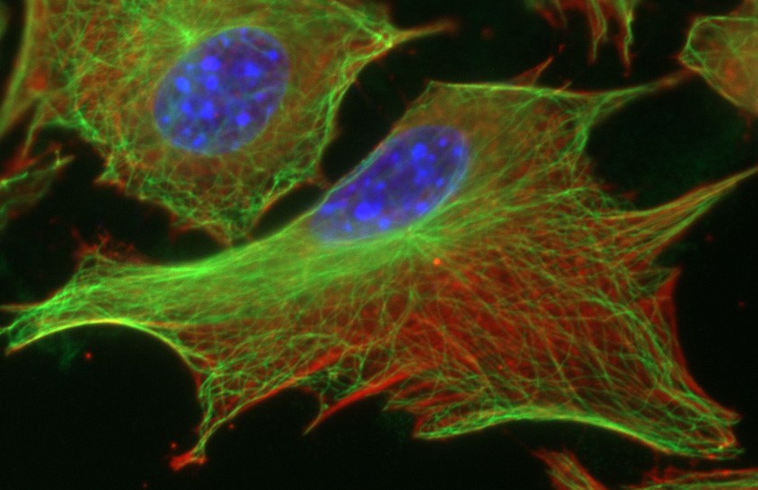 copyright: Corrine Drexler, Max Perutz Labs